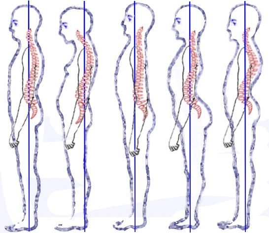 Chiropractic Posture Care - Aurora