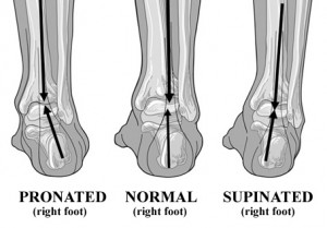 custom orthotics and knee pain