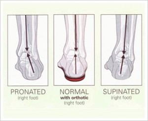 overpronation and oversupination