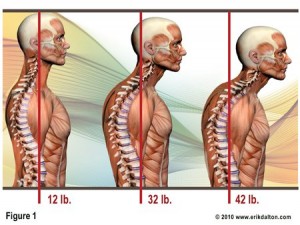 forward head posture puts more load on the back